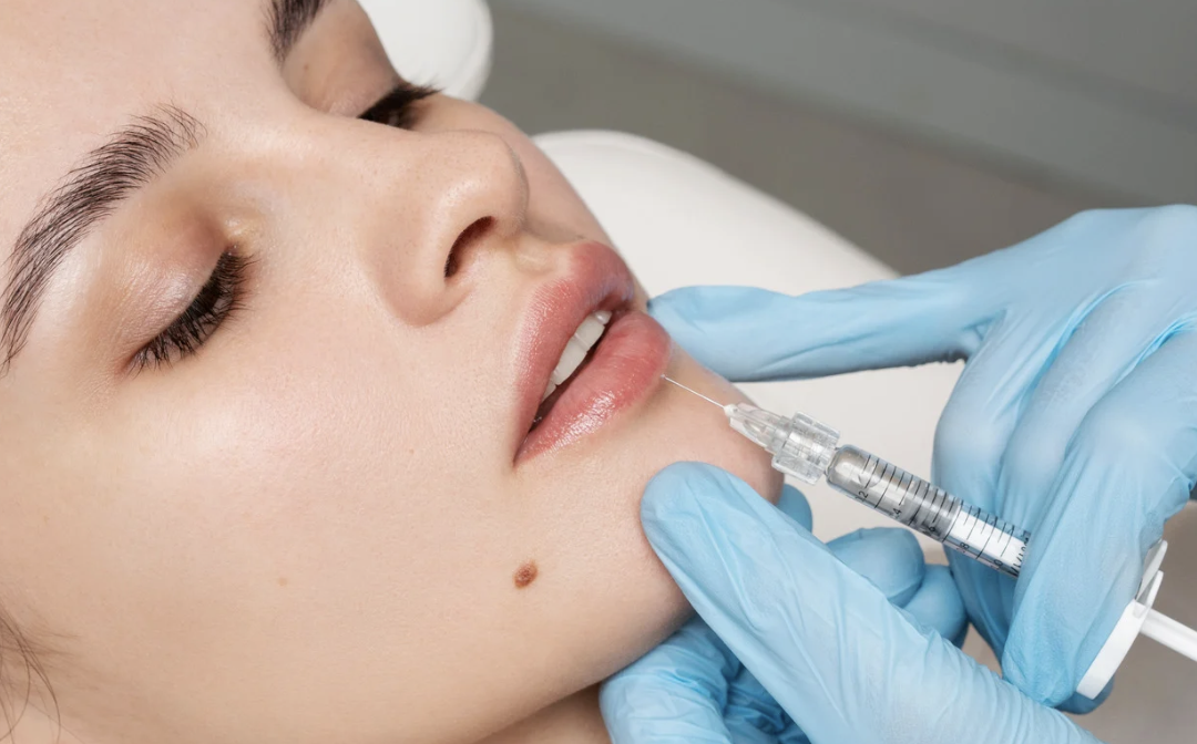 Lip Filler Consultation Appointment in Silver Spring MD